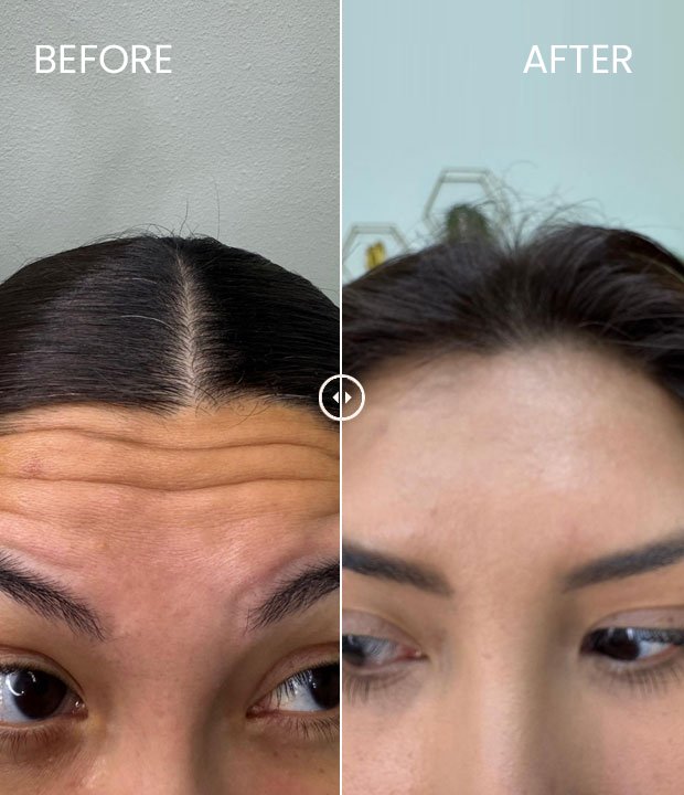 Close-up of a model's refreshed skin
